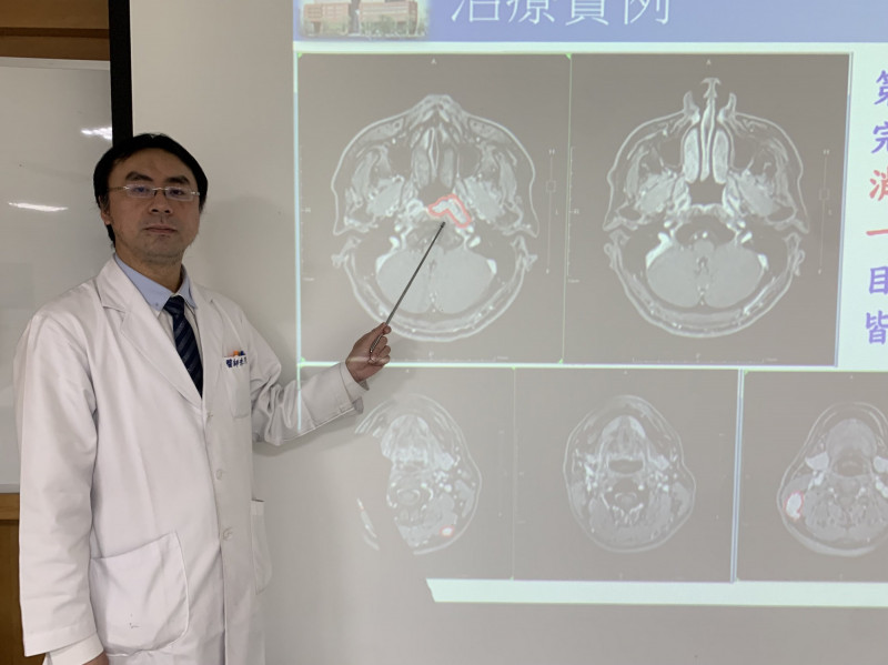 李芃逸醫師指江先生2公分大鼻咽癌腫瘤（圖左紅圈處）經放化療成功縮小到看不到。（記者蔡淑媛翻攝）